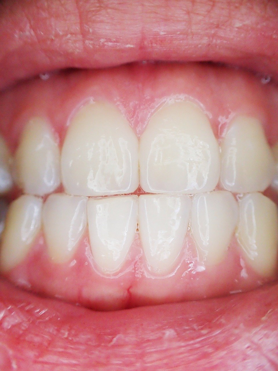 teeth-887338_1280 Image description